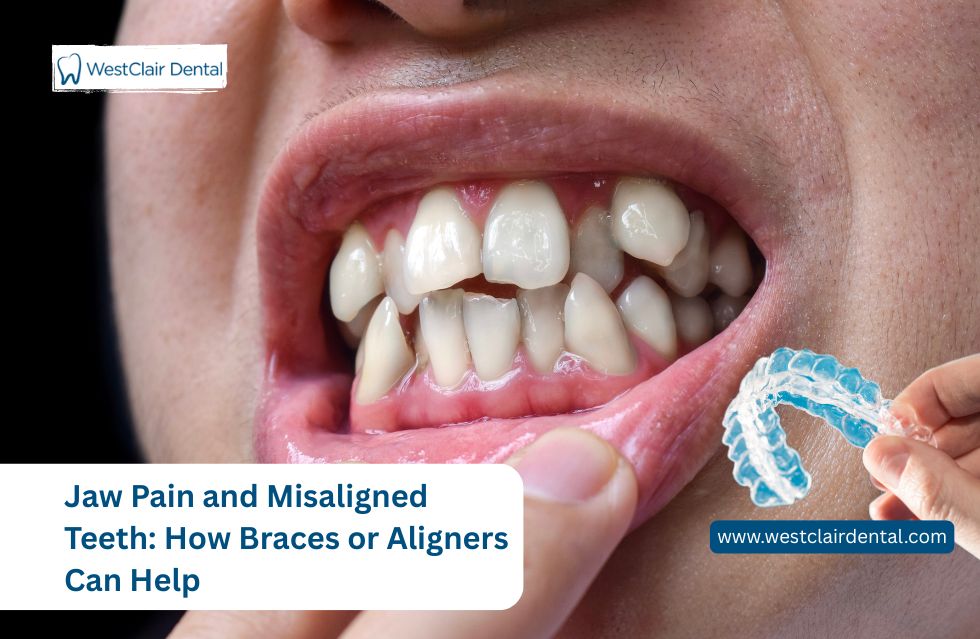Jaw Pain and Misaligned Teeth: How Braces or Aligners Can Help